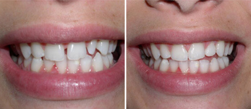 Cosmetic-Dentistry-01