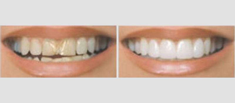 Cosmetic-Dentistry-02-1
